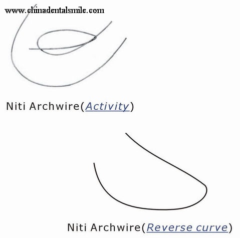 Orthodontic Activity & Reverse Curve arch wire