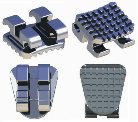 MIM Edgewise Brackets